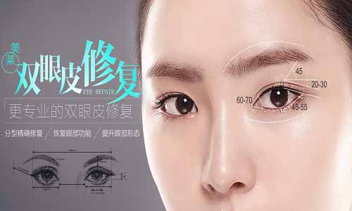 美萊雙眼皮修復